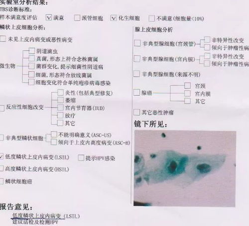 标本,注意事项,TCT