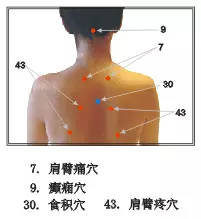 拔罐的禁忌和注意事项,拔罐注意事项和禁忌症,拔罐的操作流程及注意事项