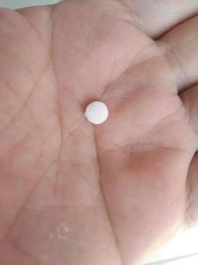荨麻疹,小儿,注意事项