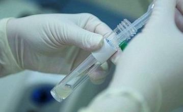 检测精子前注意事项