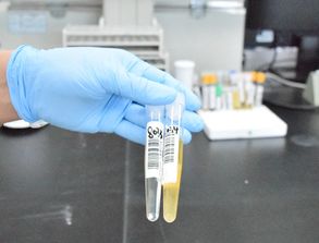 尿标本收集的注意事项,尿标本的收集和保存注意事项,尿标本采集的注意事项