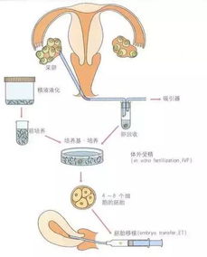 试管与自然怀孕注意事项