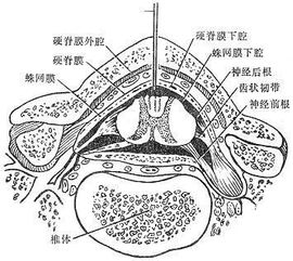 脊椎麻醉后注意事项,脊椎正骨后的注意事项,脊椎复位后注意事项