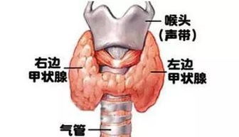 甲状腺注意事项及饮食禁忌,甲状腺3类注意事项,甲状腺穿刺后注意事项