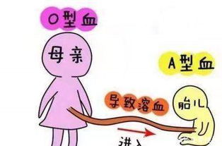 新生儿和妈妈血型不合要注意事项