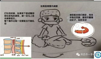 麻醉科,镇痛,注意事项