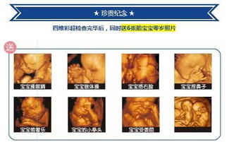 做肝脏彩超的注意事项,做彩超的注意事项,做彩超检查注意事项
