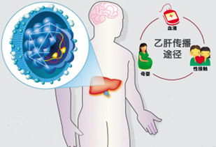 做乙肝dna前注意事项