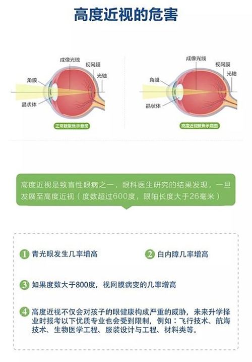 高度近视可以做手术吗,高度近视有必要做手术吗,高度近视建议做手术吗