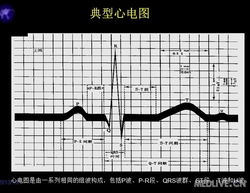 心电图基础知识讲解,心电图教学基础知识,心电图入门基础知识