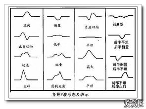心电图基础知识本科生讲座