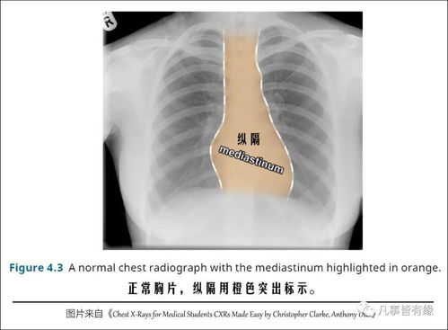 胸外泌尿基础知识