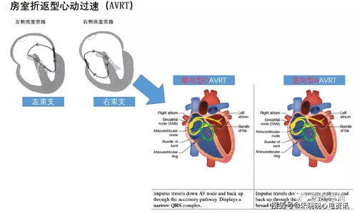 心电图基础知识网页