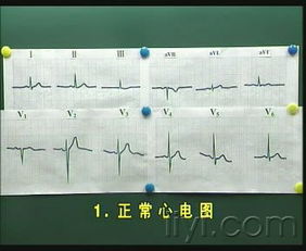 心电图基础知识教学